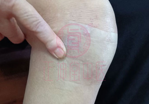 膝关节疼痛该怎么办