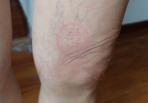 膝关节疼痛哪里治愈比较好