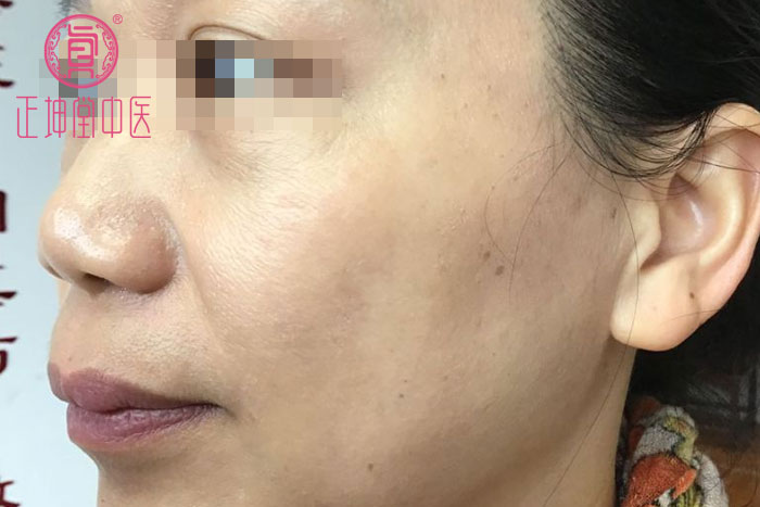 女性衰老的调理方法