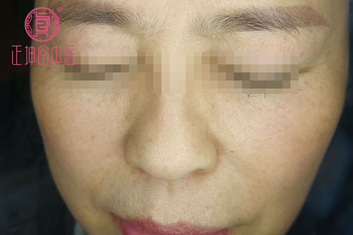 皮肤衰老的原因有哪些