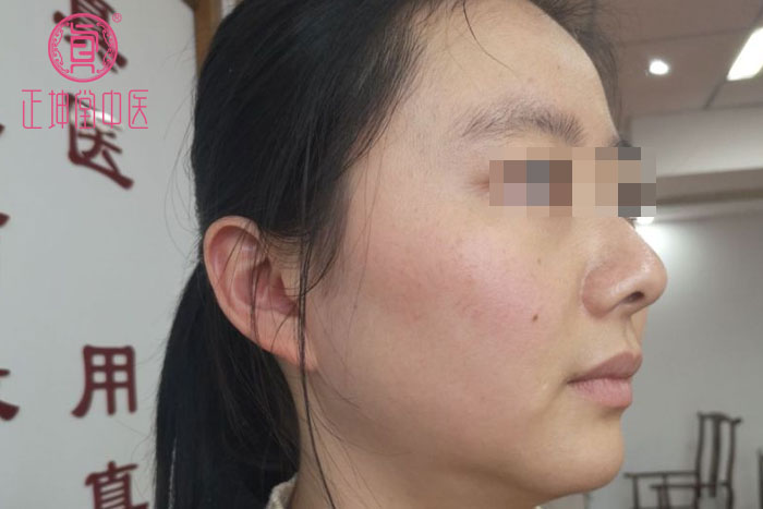 更年期衰老案例
