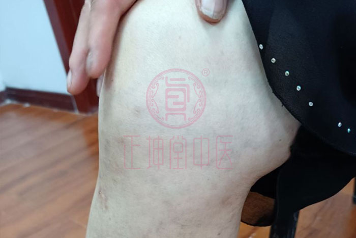 老年人膝关节疼痛怎么办？