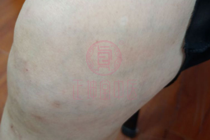 老年人膝关节疼痛怎么办？