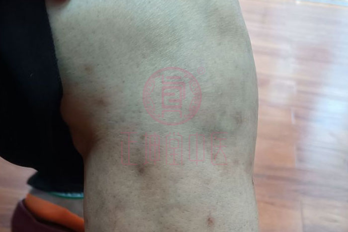 老年人膝关节疼痛怎么办？