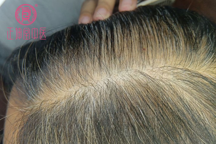 头部班头哪里比较好