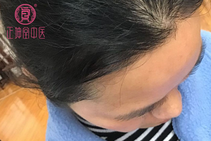 女人衰老的主要原因