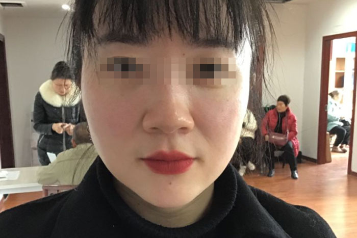 刘女士衰老治愈案例