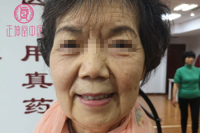 老年期衰老该怎么办