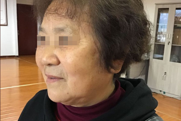 吴女士老年期衰老治愈案例