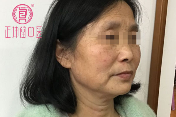 老年期衰老案例