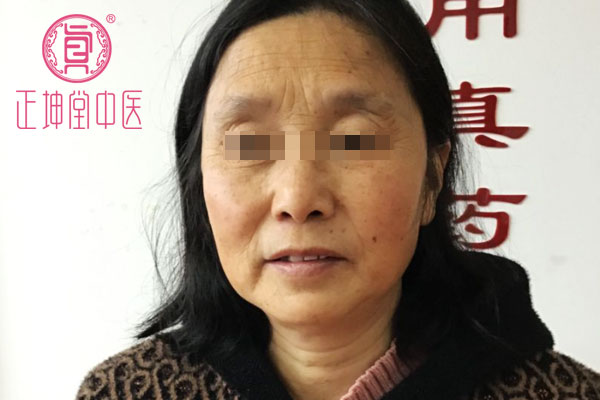 老年期衰老案例