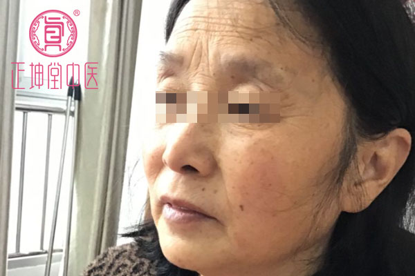 老年期衰老案例