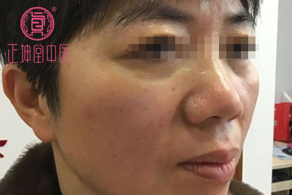 中医如何调理衰老