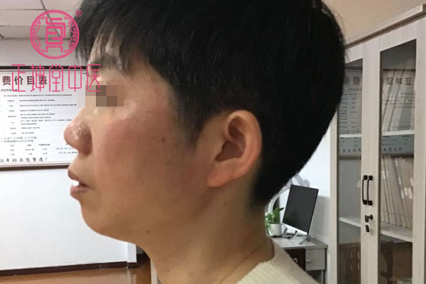 更年期衰老如何调理
