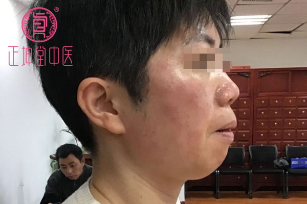 中医如何调理衰老