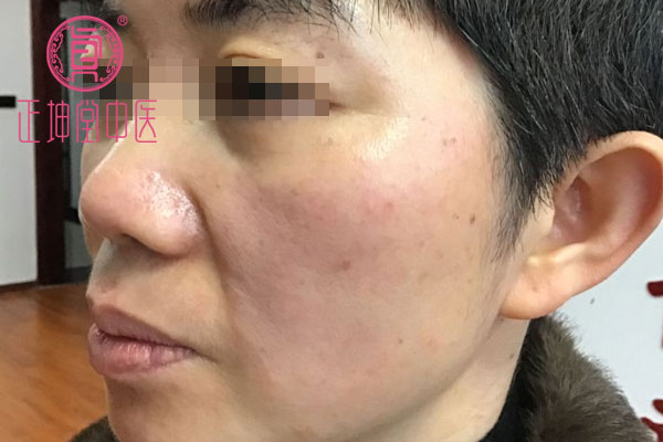 中医如何调理衰老